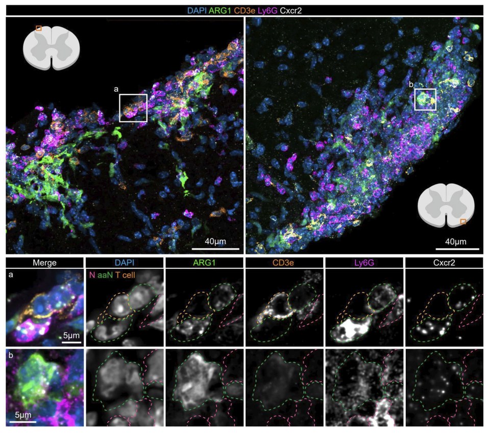 Journal of Neuroinflammation cover
