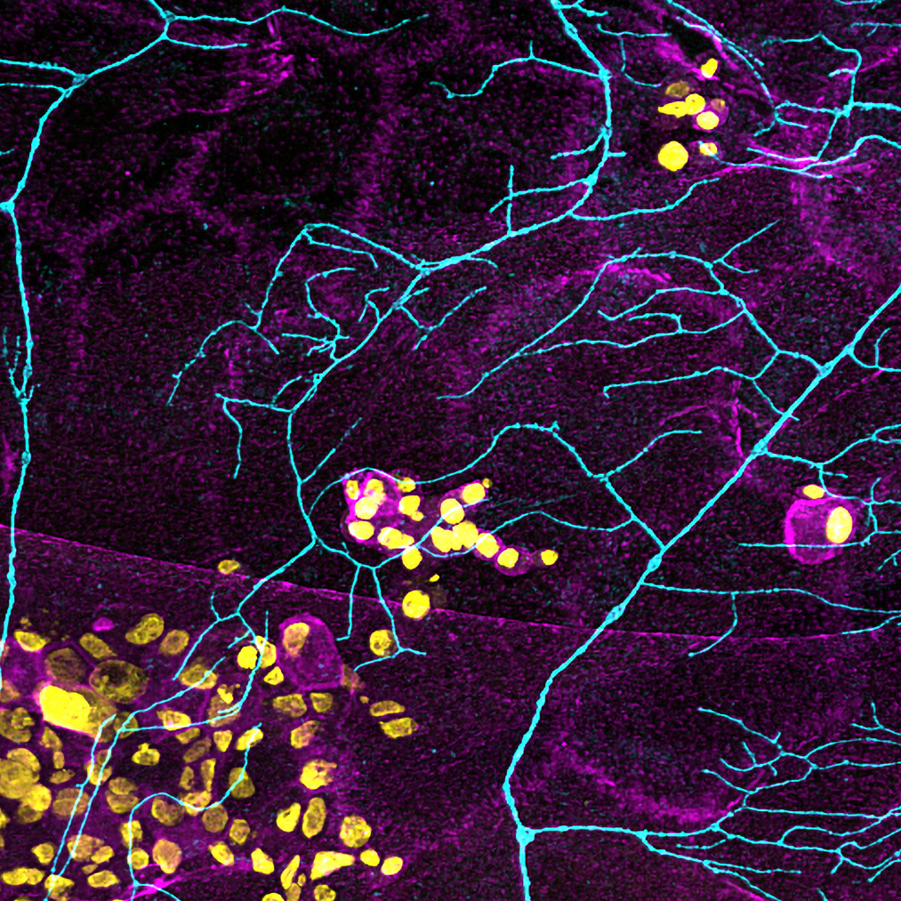 Nerve fibers (cyan) and immune cells (yellow) in tissue from a collaborative neuroinflammation and axon regeneration project.