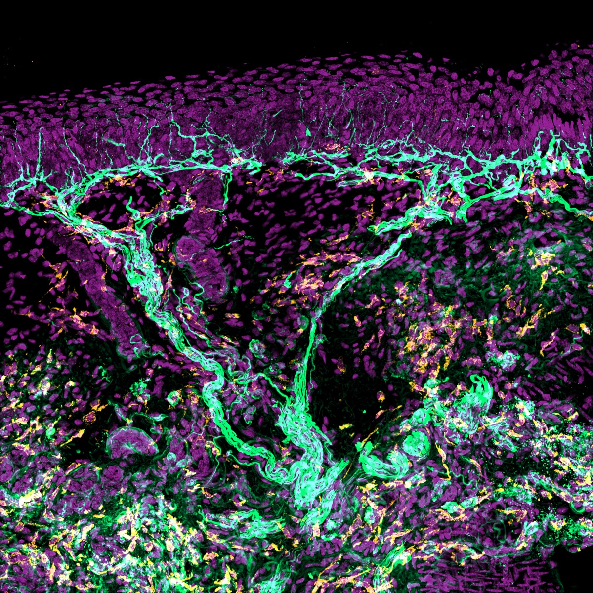 Mouse hindpaw skin imaged at high resolution, showing intraepidermal and dermal nerve fibers (cyan), immune cells (yellow), and cell nuclei (magenta).
