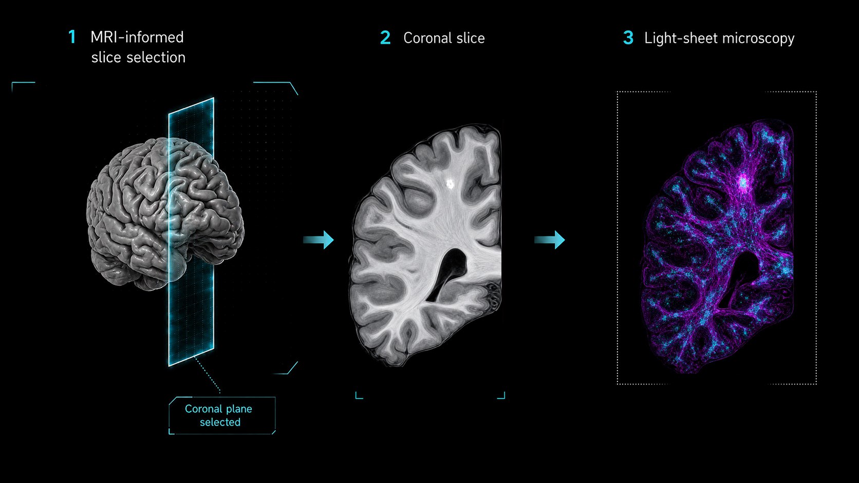 Three-step workflow: MRI-informed selection of a coronal plane through a whole brain, the resulting coronal slice, and that slice imaged by light-sheet microscopy with cellular structures resolved in multiple colours.