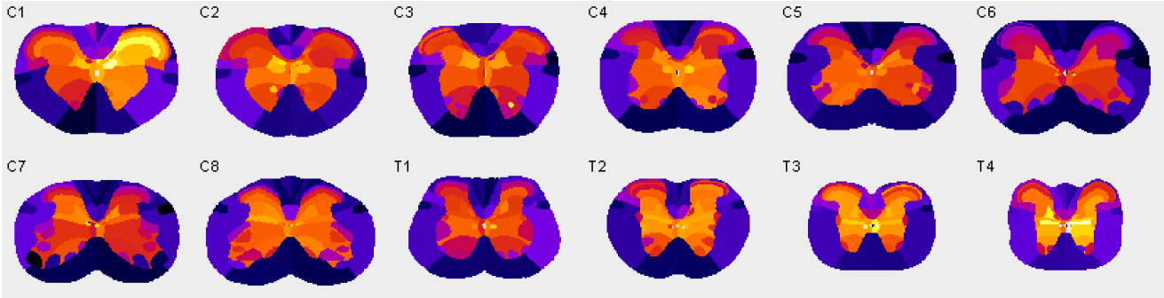 SpinalJ analysis header
